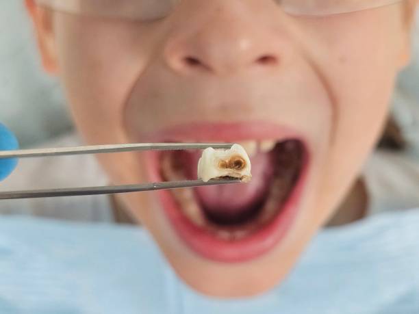 Best Emergency Dental Surgery in Chesaning, MI